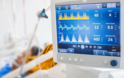 高值醫械國產替代路徑探析 微創模式與ST模式呼吸機的未來發展