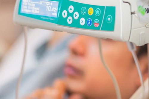 瑞思邁S9 Auto25與VPAP ST呼吸機對比 哪款更適合ST模式需求？