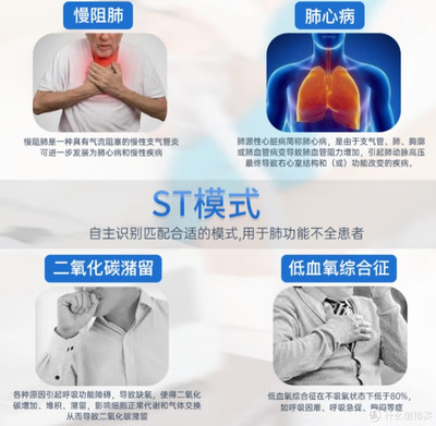 家用呼吸機推薦 為何ST模式呼吸機被譽為“超級好用”的睡眠健康守護者